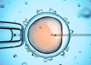 体外受精 IVF-ET
